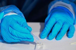 A healthcare worker places solution droplets into a rapid antigen Covid-19 test at a Reliant Health Services testing site in Hawthorne, California, on January 18.