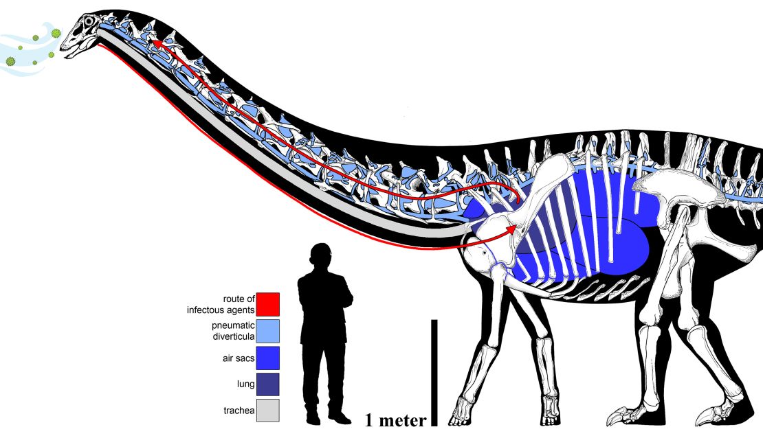 This diagram shows the pathway Dolly's infection might have taken. The human figure included for scale is Dr. Anthony Fauci.