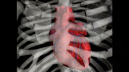 How old is your heart? AI predicts “heart age” and pinpoints link