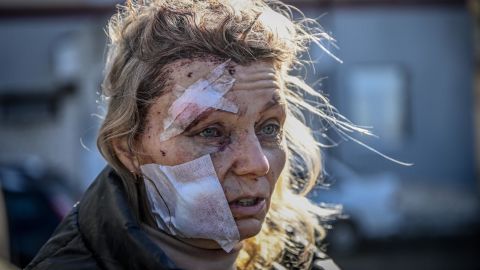 A woman injured by a Russian strike on the Ukrainian town of Chuguiv in February 2022.