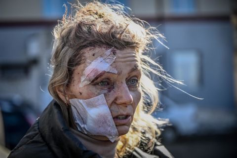 A wounded woman stands outside a hospital after an attack on the eastern Ukrainian town of Chuhuiv, outside of Kharkiv, on February 24.