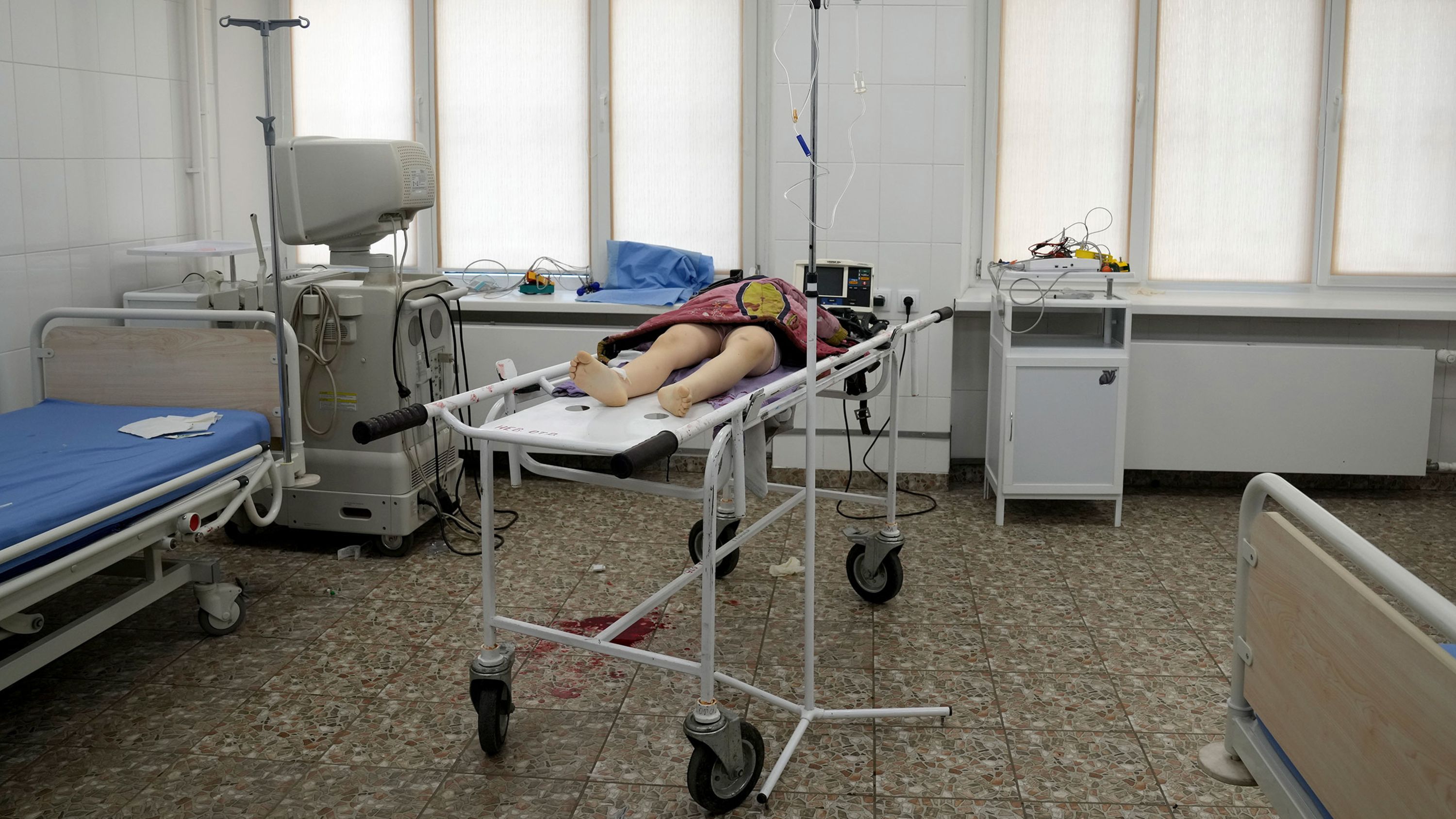 The lifeless body of a 6-year-old girl, who <a href="index.php?page=&url=https%3A%2F%2Fapnews.com%2Farticle%2Frussia-ukraine-europe-a8bb96288aaf70f9a7f70e9a4fac8160" target="_blank" target="_blank">according to the Associated Press</a> was killed by Russian shelling in a residential area, lies on a medical cart at a hospital in Mariupol, Ukraine, on Sunday, February 27. The girl, whose name was not immediately known, <a href="index.php?page=&url=https%3A%2F%2Fwww.cnn.com%2F2022%2F02%2F28%2Feurope%2Fgallery%2Fukraine-girl-killed%2Findex.html" target="_blank">was rushed to the hospital but could not be saved.</a>