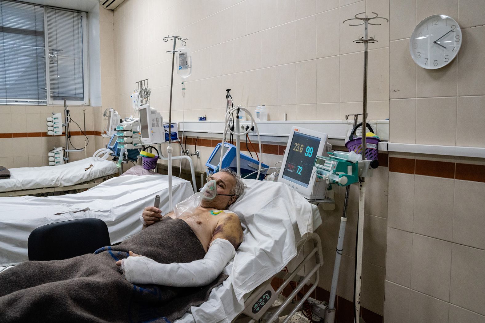 Leos Leonid recovers at a hospital in Kyiv on March 3. The 64-year-old survived being crushed when an armored vehicle drove over his car. <a href="index.php?page=&url=https%3A%2F%2Fwww.cnn.com%2Fvideos%2Fworld%2F2022%2F02%2F27%2Fbystanders-military-vehicle-ukraine-sot-vpx.cnn" target="_blank">Video of the incident</a> was widely shared on social media.