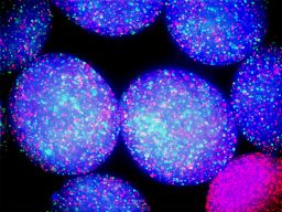 Bacteria are able to find both isolated and shared enviornments in sponges.