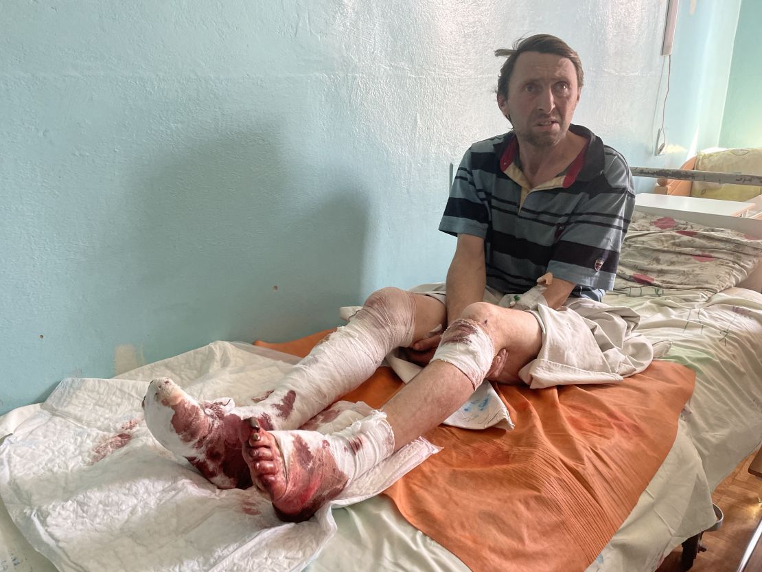 Igor Rubtsov says he was struck by shelling while feeding animals on the street where he lives.