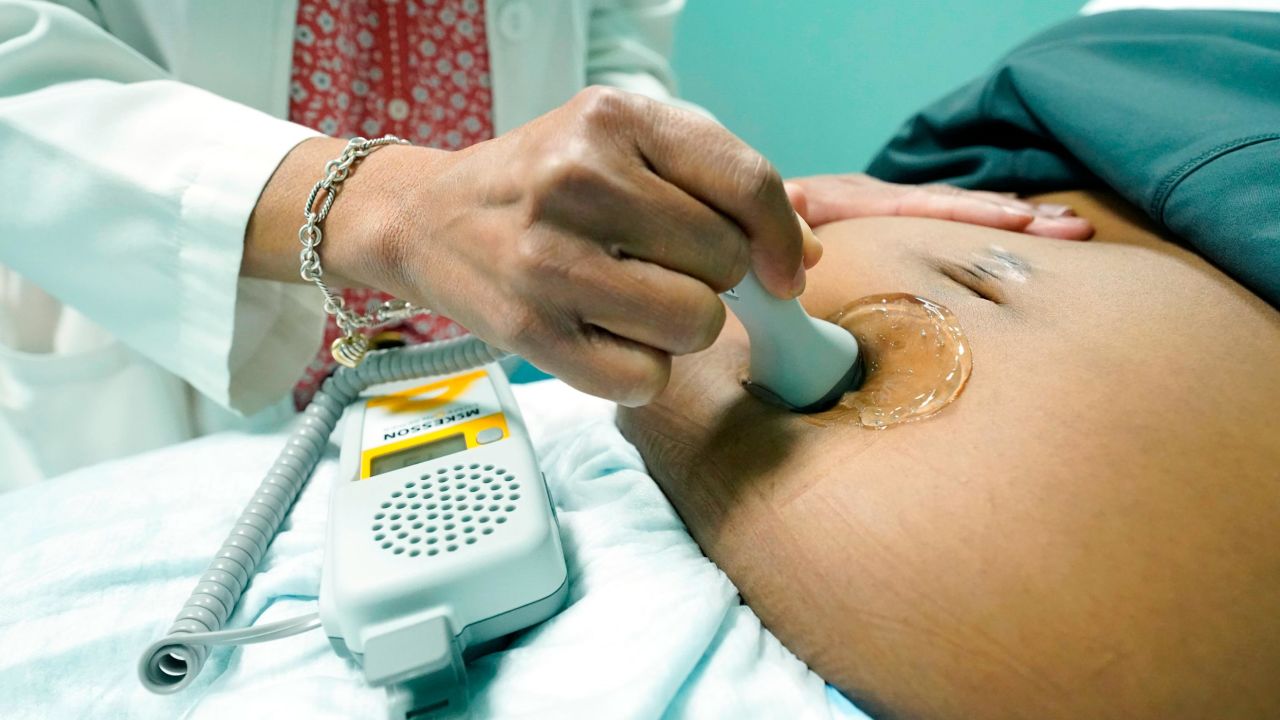 The US had the highest maternal mortality rate of any nation studied: 23.8 deaths per 100,000 live births.