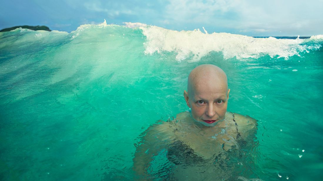 <strong>Deep dive: </strong>Rachel Fleit, a writer, director and advocate of people living with alopecia, is featured in the All-Inclusive Photo Project (AIPP) campaign from Celebrity Cruises.
