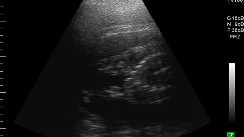The zoo shared an ultrasound image showing Bibi the hippo's unborn baby.