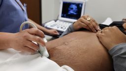 Dr. Ericka Jaramillo does an ultrasound on a patient from Austin, Texas, before her surgical abortion at Trust Women clinic in Oklahoma City, U.S., December 6, 2021. Picture taken December 6, 2021. REUTERS/Evelyn Hockstein
