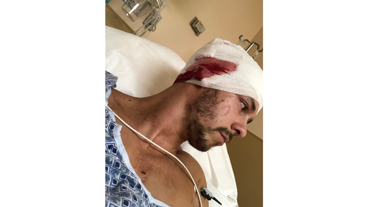 This photo shows Jeffrey Heim recuperating after his attack and the extent of the injuries to his head.