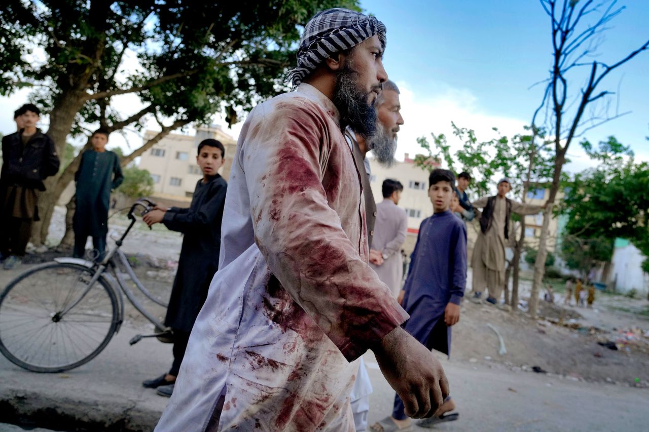 A man's outfit is stained by blood after there was a <a href="https://www.cnn.com/2022/04/29/asia/kabul-mosque-explosion-intl/index.html" target="_blank">deadly explosion at a mosque</a> in Kabul, Afghanistan, on Friday, April 29. A series of deadly blasts has rocked several Afghan cities over the past few weeks.