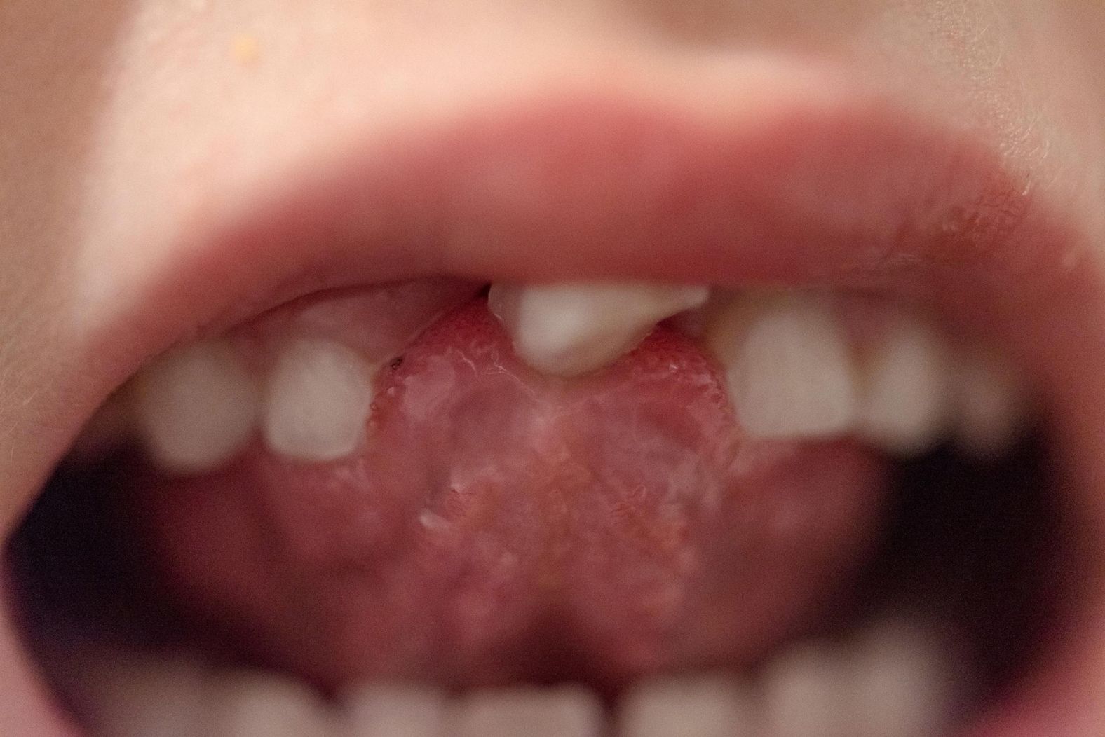 <a href="https://www.kristinenyborg.com/" target="_blank" target="_blank">Kristine Nyborg</a> photographed her daughter minutes before she lost her front tooth. "During the pandemic, our children collectively lost 12 teeth," she said, "and we had a hard time finding coins as the local stores stopped using physical money in our neighborhood." She has three children who were born 15 months apart. "I go to bed exhausted every night, yet every morning they are the people I'm the most excited to see. They have taught me more about living than any other season in my life."