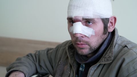 A survivor of a Russian strike in eastern Ukrainian is seen at a hospital on Sunday.