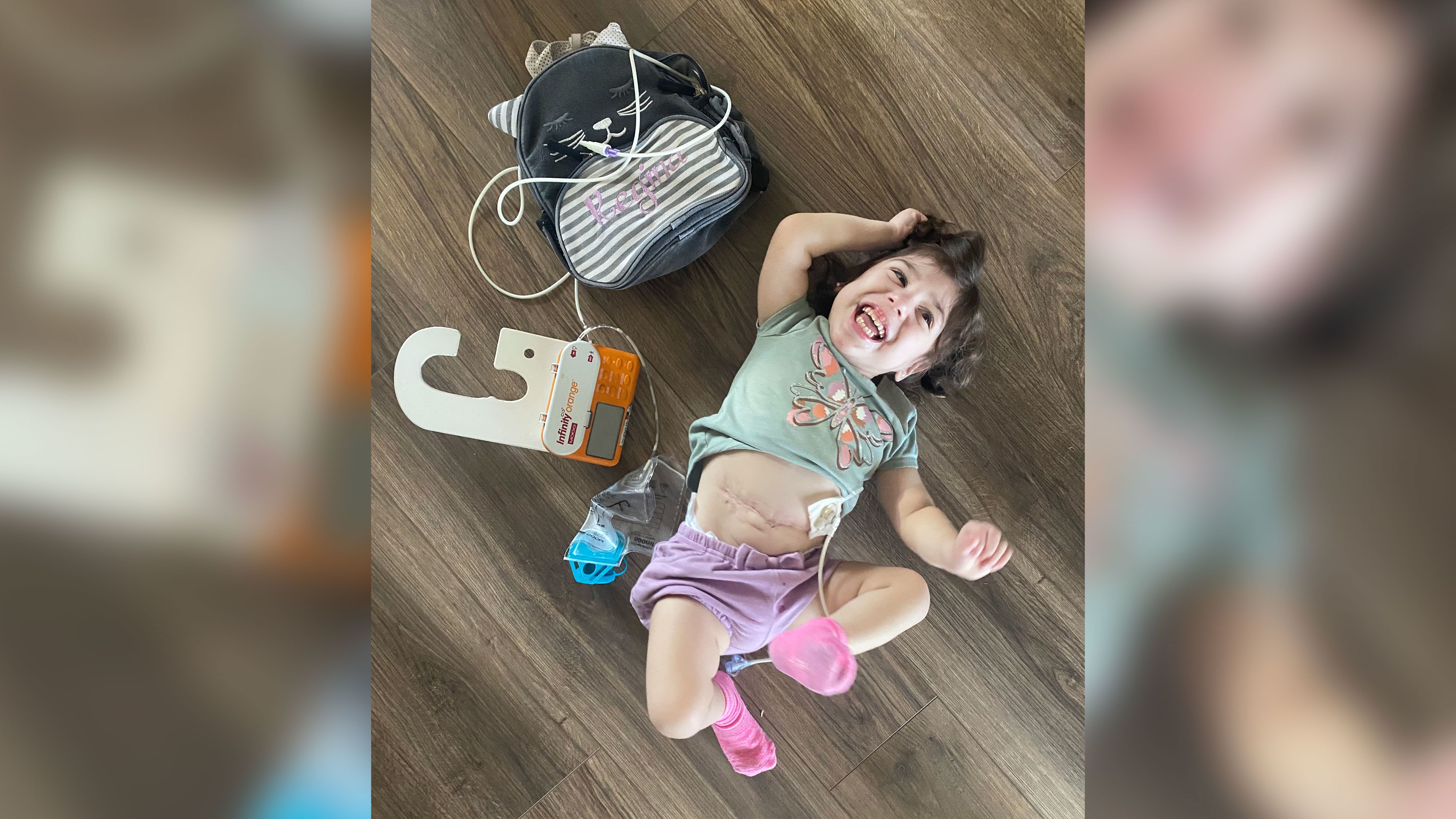 Regina Orozco, 2, lies next to her feeding tube, a device she has relied on since birth for nutrition. 