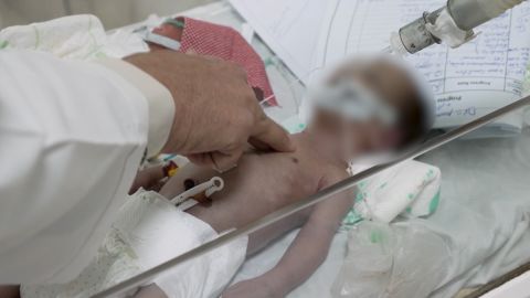 A malnourished child under a doctor's care in Afghanistan.