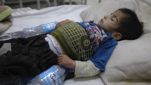 Two-year-old Mohammad lies in a small bed in the malnutrition ward at the Indira Gandhi Children's Hospital in Kabul.