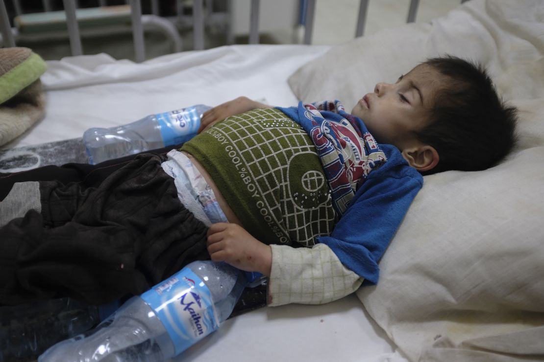 Two-year-old Mohammad lies in a small bed in the malnutrition ward at the Indira Gandhi Children's Hospital in Kabul.