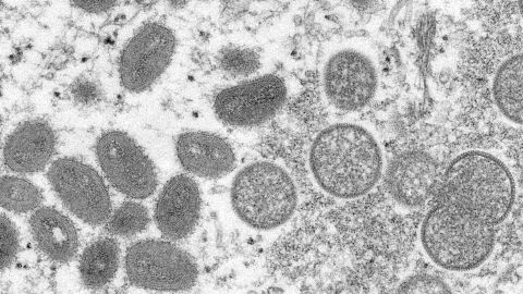 This 2003 electron microscope image made available by the US Centers for Disease Control and Prevention shows mature, oval-shaped monkeypox virions, left, and spherical immature virions, right, obtained from a sample of human skin associated with the 2003 prairie dog outbreak.