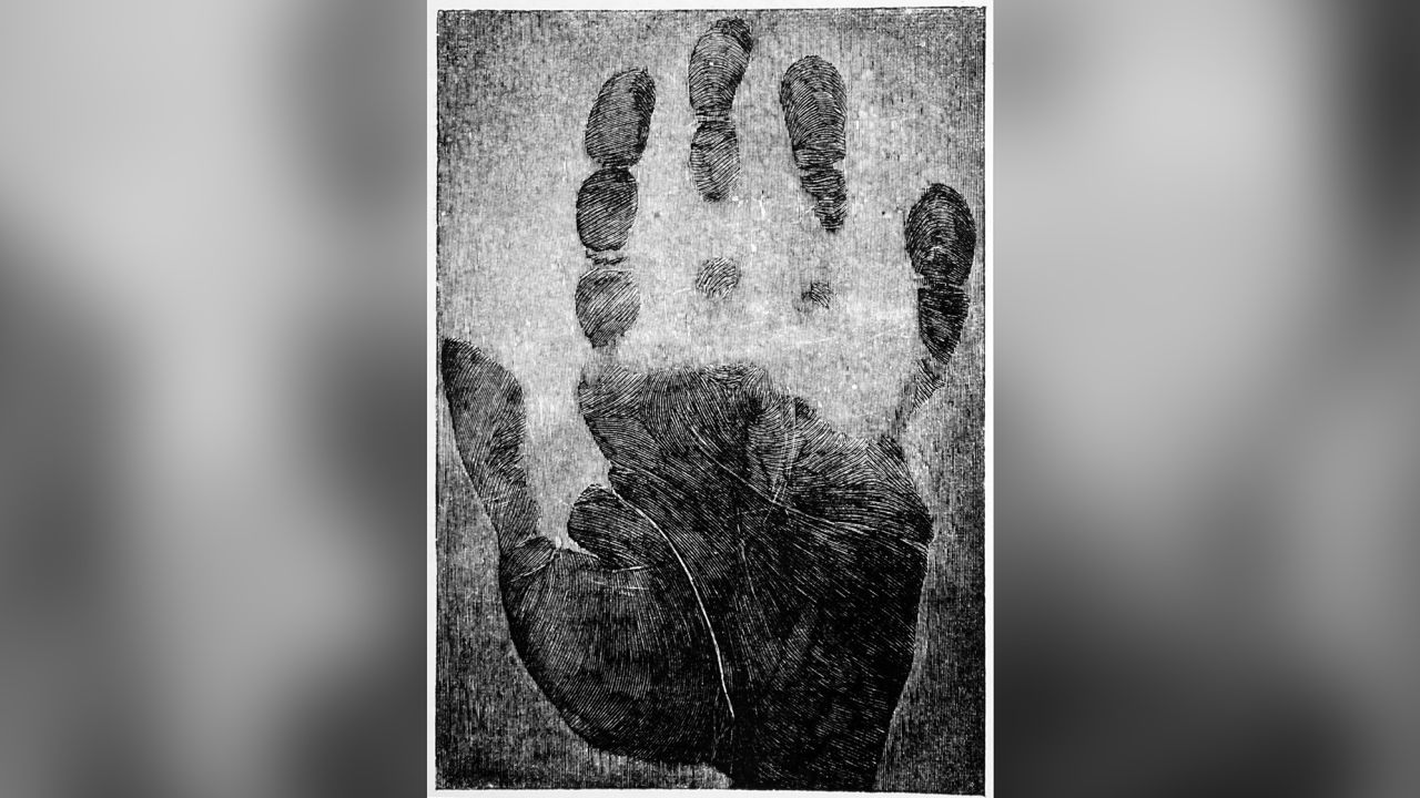 Hand print with reference grid superimposed, used to identify criminals. Dated 19th Century. (Photo by: Universal History Archive/Universal Images Group via Getty Images)