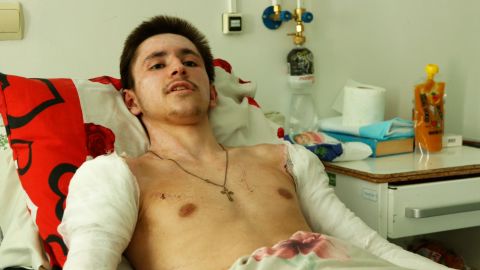يعالج أوليكسي بارادوفسكي من إصاباته جراء الانفجار في مستشفى في أوديسا.