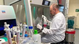 Head of the Institute of Microbiology of the German Armed Forces Roman Woelfel works in his laboraty in Munich, May  20, 2022, after Germany has detected its first case of monkeypox.  