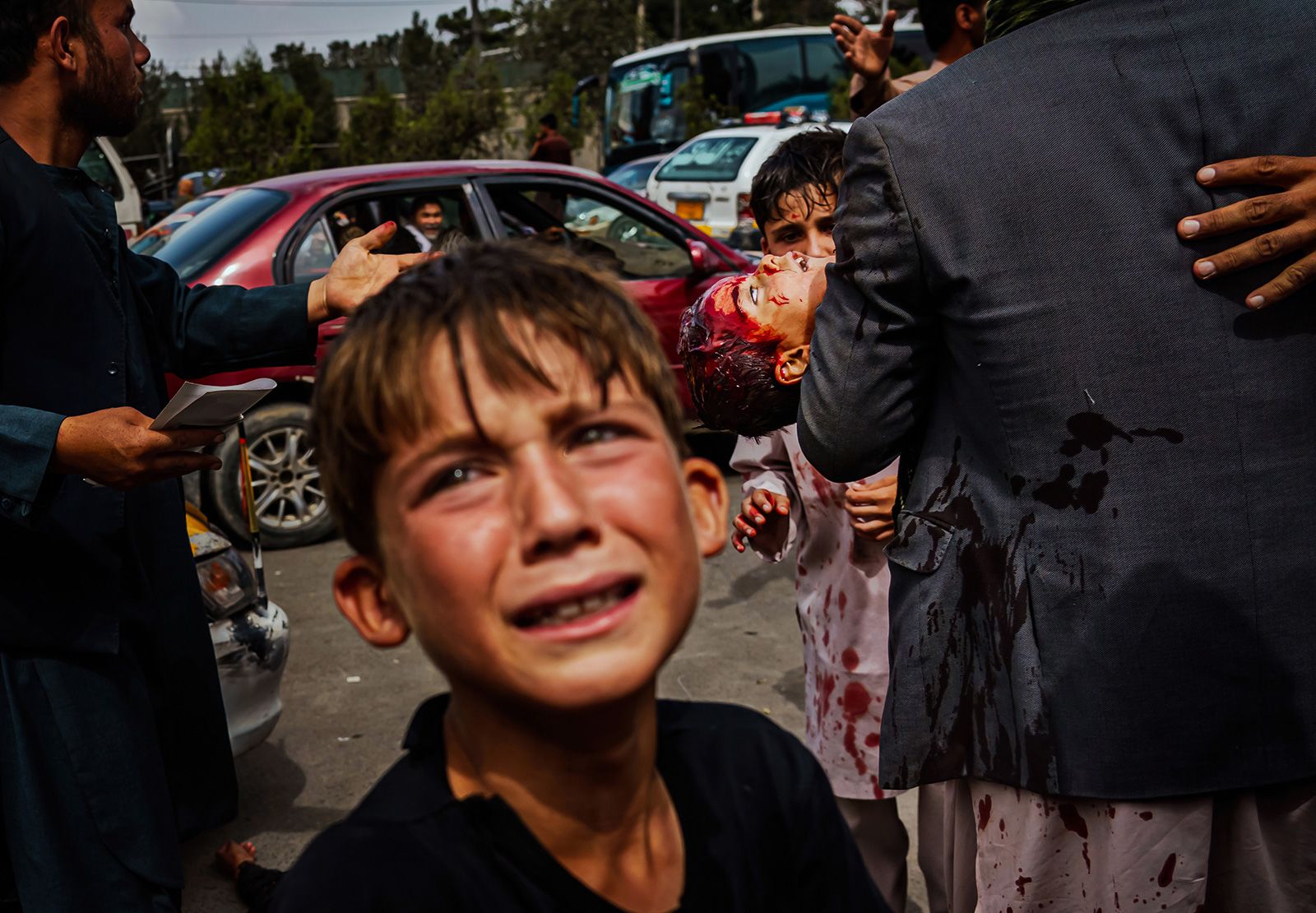 August 17, 2021: A traumatized child cries as behind him a man covered in blood carries an injured child. Some Afghans were wounded by Taliban fighters pushing them back from the airport using gunfire, whips and sticks.