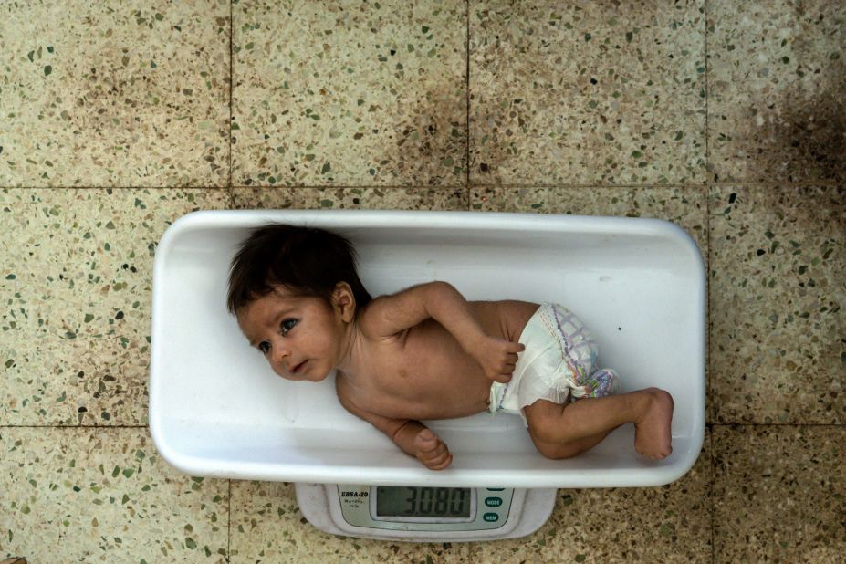 A malnourished baby is weighed at the Indira Gandhi hospital in Kabul, Afghanistan, on Sunday, May 22. <a href="https://www.cnn.com/2022/05/17/us/iyw-how-to-help-afghanistan-hunger-crisis/index.html" target="_blank">Hunger and food insecurity</a> have reached catastrophic levels in Afghanistan. The World Food Program reports that almost 20 million people — about half the country's population — are in desperate need of food.