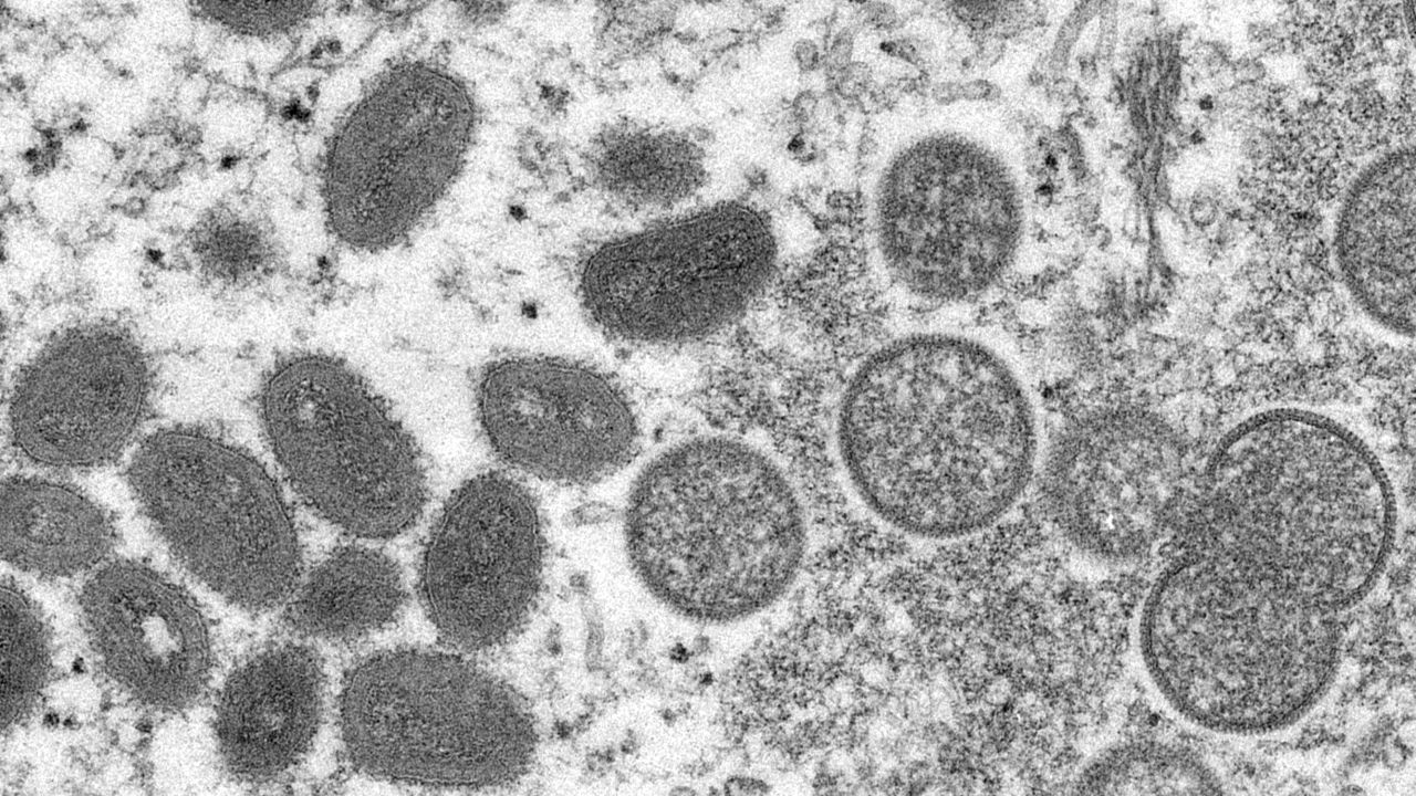 This 2003 electron microscope image made available by the Centers for Disease Control and Prevention shows mature, oval-shaped monkeypox virions, left, and spherical immature virions, right, obtained from a sample of human skin associated with the 2003 prairie dog outbreak. 