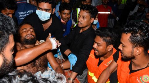 An injured victim is brought to a hospital following the blaze.