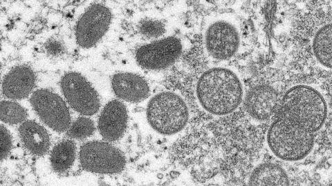 Een microscoopbeeld van volwassen, ovaalvormige virionen van apenpokken, links, en bolvormige onrijpe virions, rechts, verkregen uit een monster van menselijke huid. 