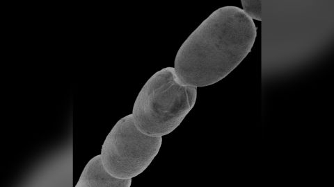 Named Thiomargarita magnifica, the bacterium is thousands of times larger than other known bacteria.