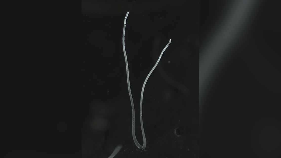 It can reach up to 2 centimeters, according to a new study.