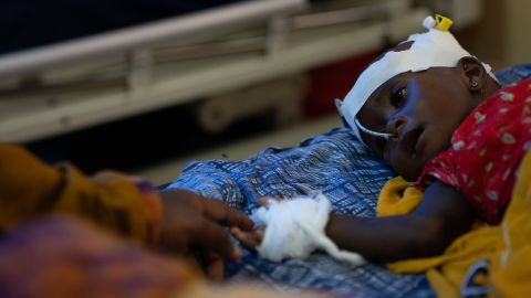 تمد فاطمة عبد الله يدها لتلمس ابنتها عبدي البالغة من العمر 8 أشهر ، والتي دخلت المستشفى بسبب سوء التغذية الحاد في الصومال في يوليو / تموز.