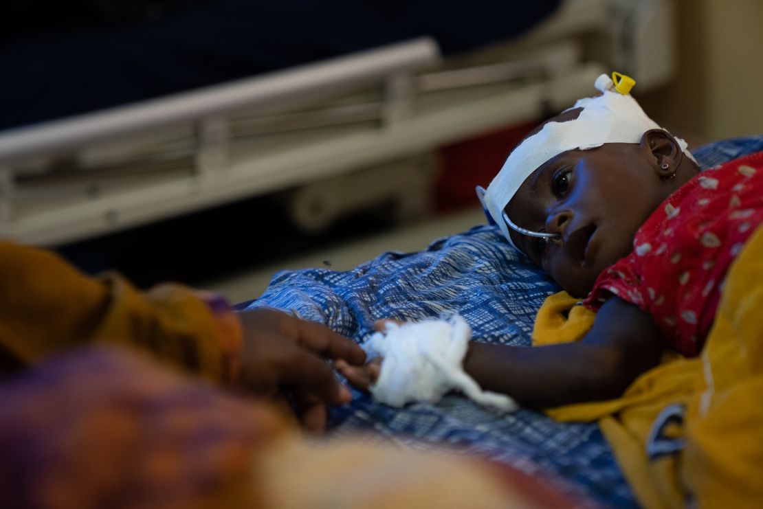 Fatima Abdullahi extends her hand to touch her 8 month old daughter Abdi, hospitalized for severe malnutrition. Doctors say she, like vast majority of the cases that they catch in time and are able to treat, will recover.