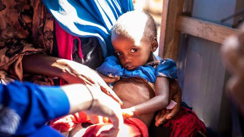 18-month-old Muslimo weighs just 10 pounds, little more than a newborn.