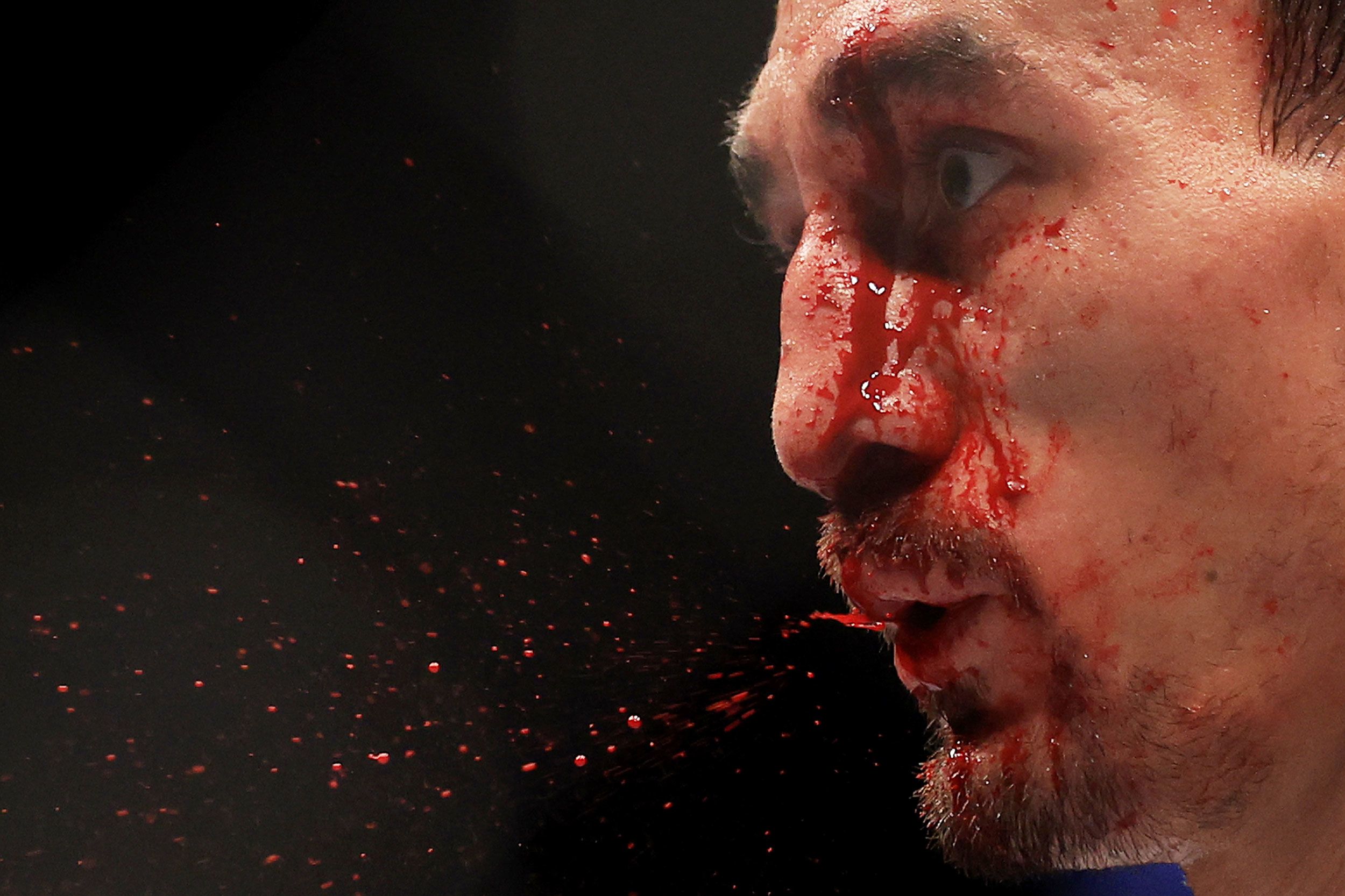 Blood falls off UFC fighter Max Holloway during a featherweight title bout in Las Vegas on Saturday, July 2.