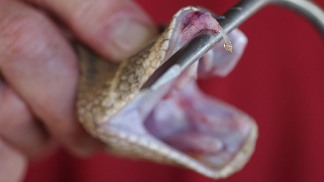 A western diamondback rattlesnake is milked for venom at a rattlesnake roundup in Kansas. The venom is then used to help produce antivenom to treat snakebites. If you're bitten, the venom from a rattlesnake begins to digest the flesh, causing intense pain and swelling. 