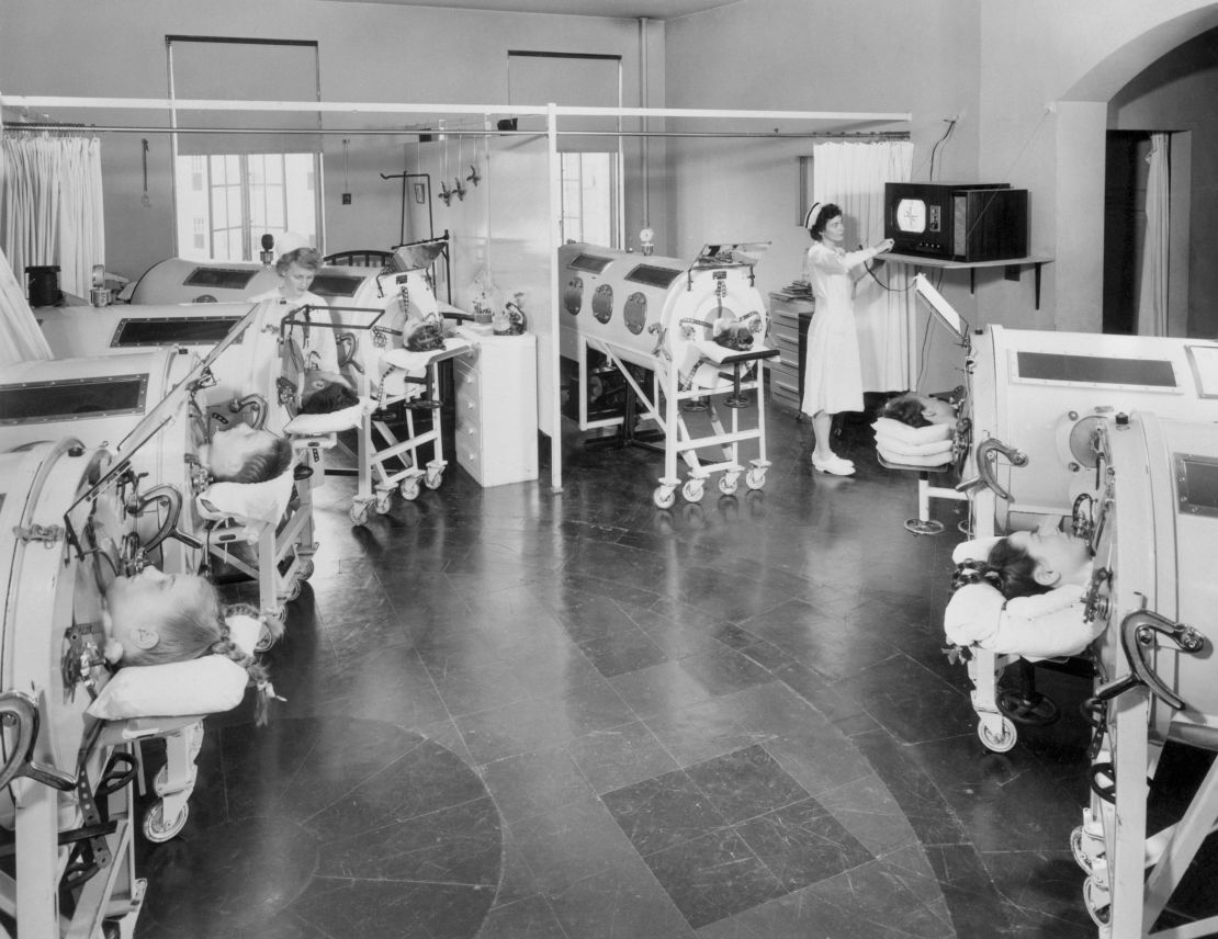 Iron lung patients at a Baltimore hospital get TVs for the first time. Mirrors allow them to watch broadcasts.