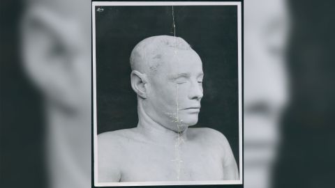 A plaster cast was made of the Somerton man's face when efforts to discover his identity failed.