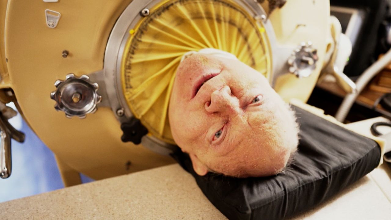 Paul Alexander has lived in an iron lung for 70 years.