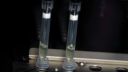 Two samples of suspected cases of monkeypox go through a process of nucleic acid extraction as they get tested at a microbiology lab at La Paz Hospital in Madrid, Spain, June 1, 2022. 