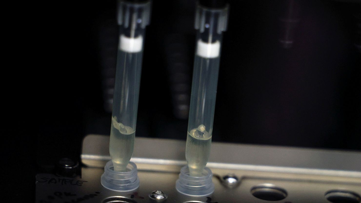 Spain reported its first monkeypox-related death on July 29, 2022.