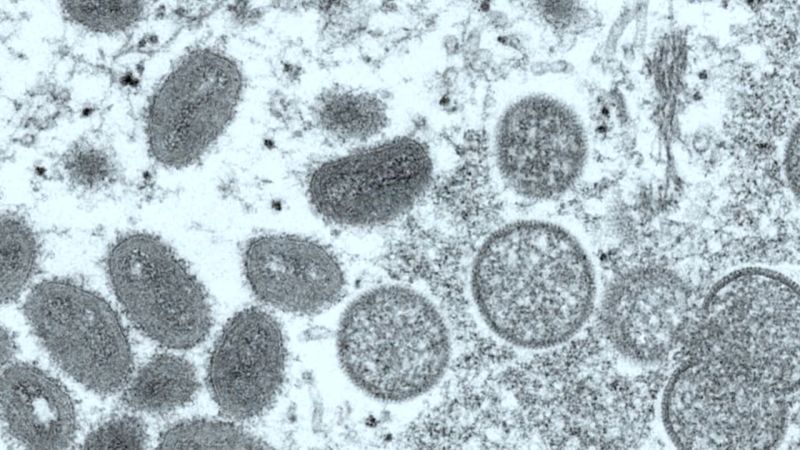 Monkeypox: Kematian pertama di AS akibat virus dikonfirmasi di Los Angeles County