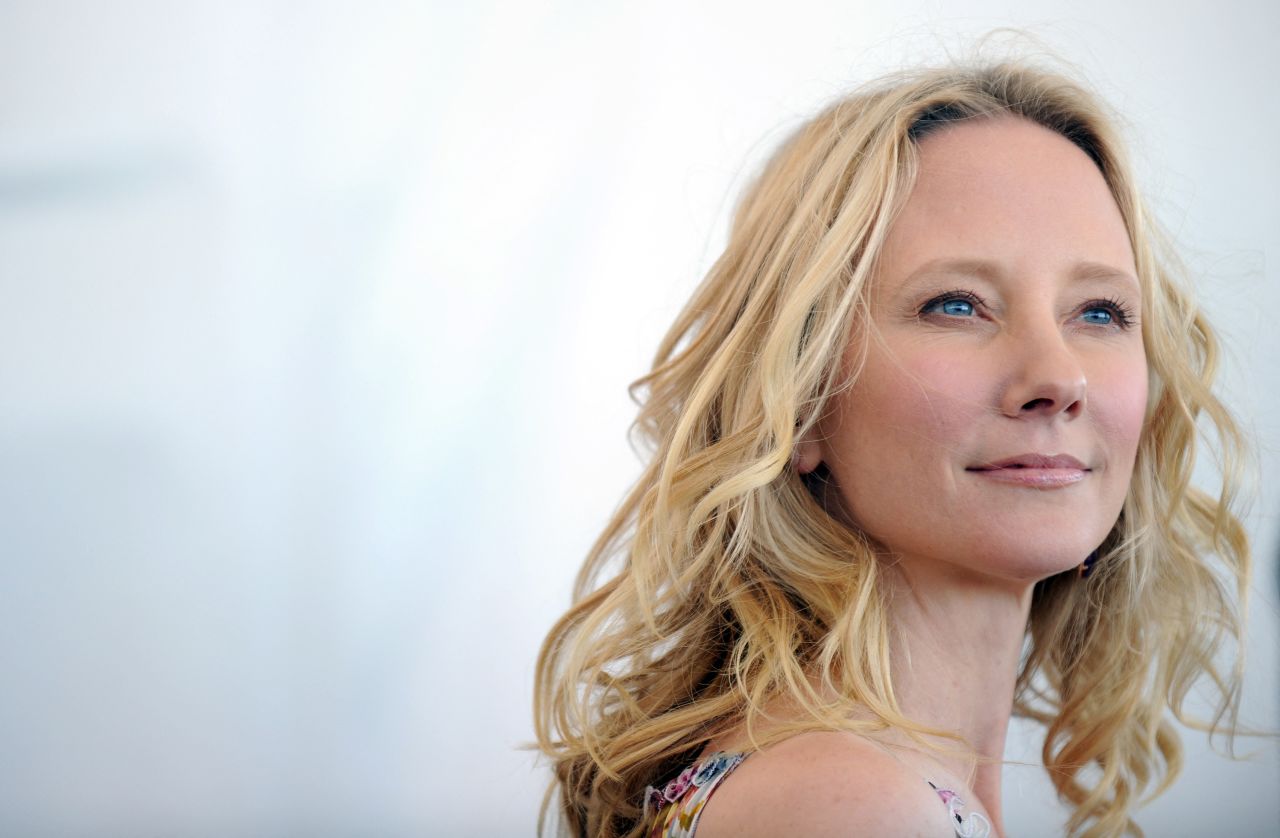 <a href="https://www.cnn.com/2022/08/14/entertainment/anne-heche-taken-off-life-support/index.html" target="_blank">Anne Heche,</a> an entrancing actor whose versatility powered an admirable career spanning four decades, died after being removed from life support on August 14. Heche's car crashed into a Los Angeles home and erupted into flames on August 5. She was 53.