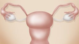  This illustration shows the vagina, uterus, eustachian tubes, and ovaries. 