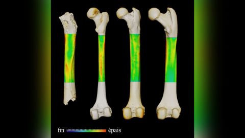 This image shows the thickness variation map for the femurs of (from left to right) Sahelanthropus, an extant human, a chimpanzee and a gorilla (in posterior view). 