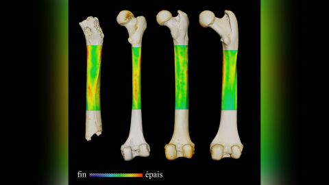 This image shows the thickness variation map for the femurs of (from left to right) Sahelanthropus, an extant human, a chimpanzee and a gorilla (in posterior view).