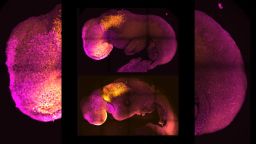 Natural (top) and synthetic (bottom) embryos to show comparable brain and heart formation