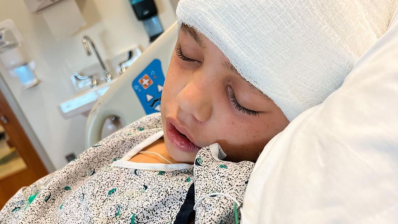 Injured Little Leaguer Easton Oliverson out of surgery, doctors 'happy
