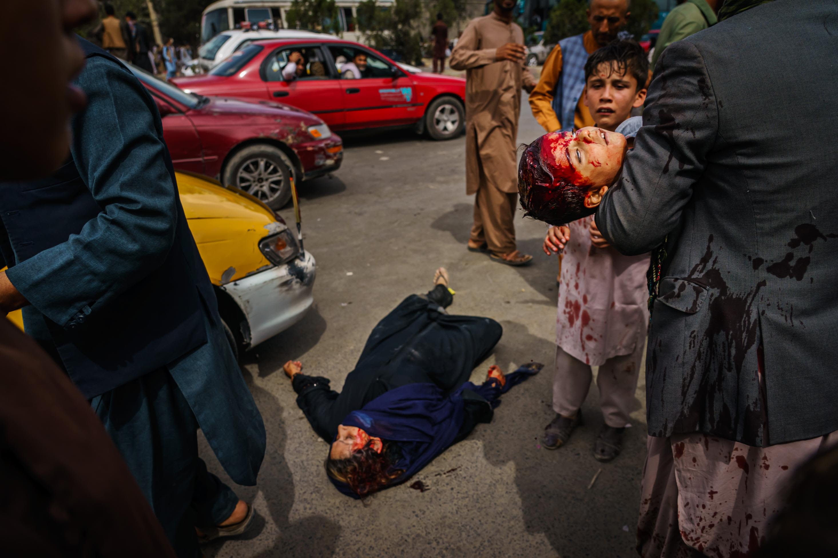 A man carries a bloodied child as a wounded woman lies on the street after Taliban fighters fired guns and lashed out with whips, sticks and sharp objects to control a crowd outside the airport in Kabul in August 2021.